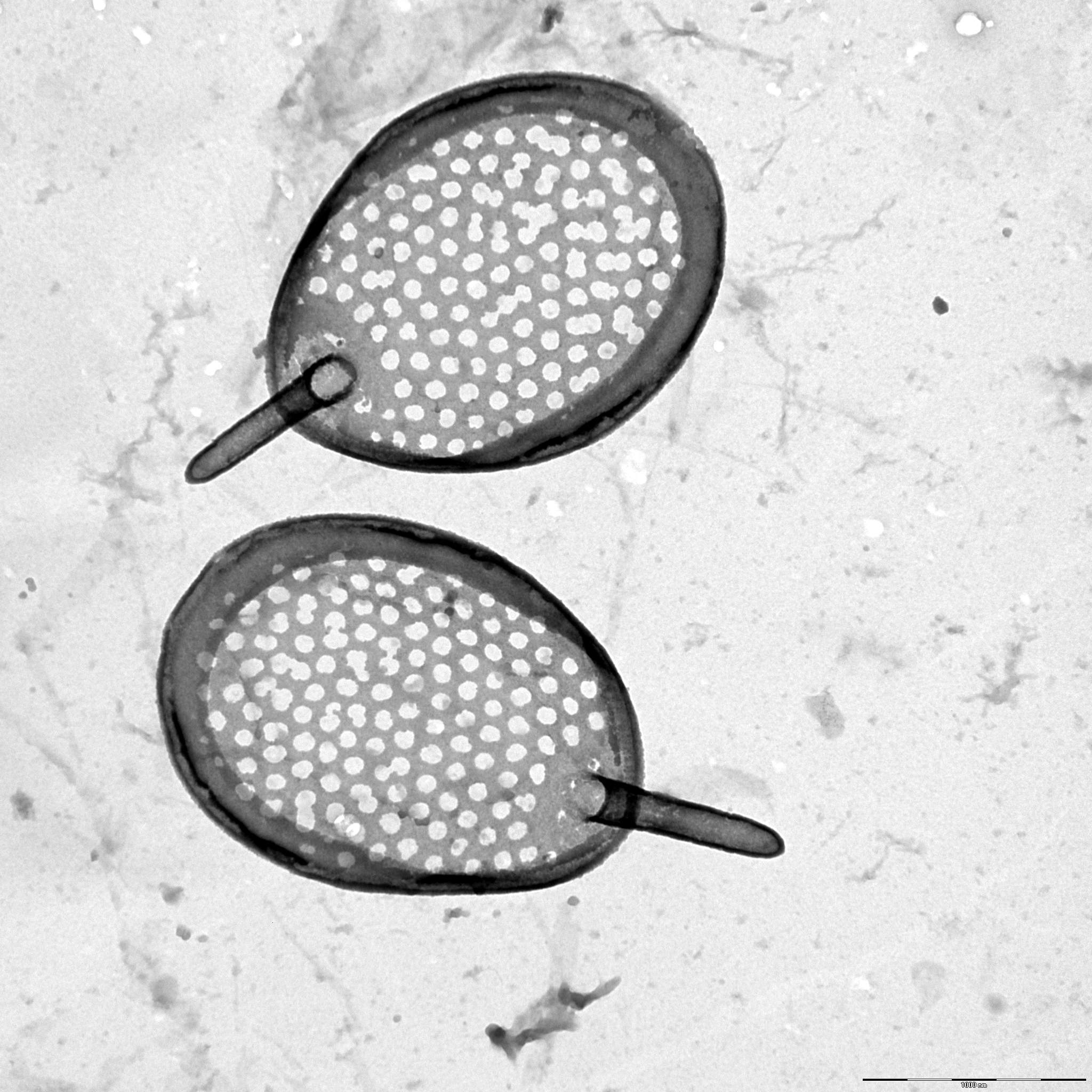 Synura rubra | Silica-scaled chrysophytes of Europe